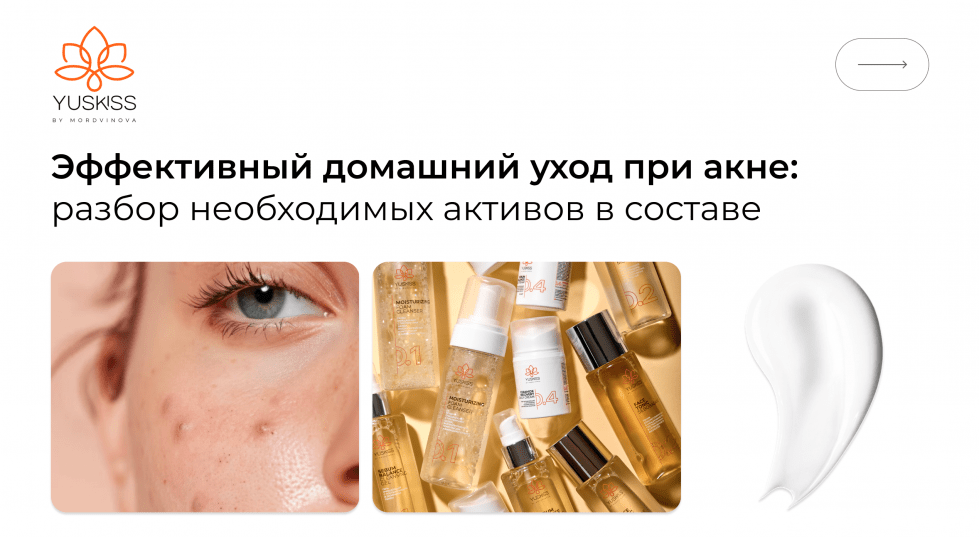 Эффективный домашний уход при акне: разбор необходимых активов